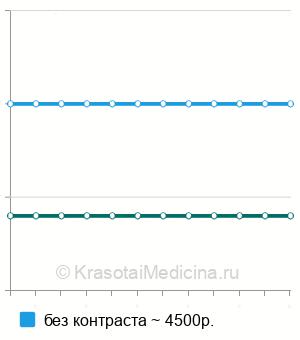 Средняя стоимость МРТ стопы в Казани