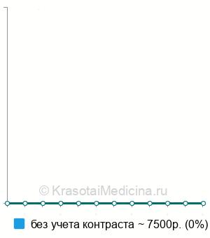 Средняя стоимость МРТ наружных половых органов у мужчин в Казани