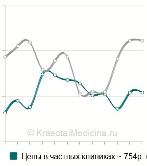 Средняя стоимость рентген крестца в Казани