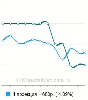 Средняя стоимость рентген ребер в Казани