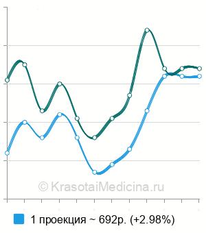 Средняя стоимость рентген лопатки в Казани