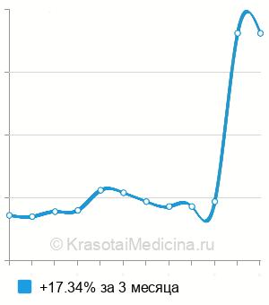 Средняя стоимость анализ на антитела к возбудителю столбняка в Казани