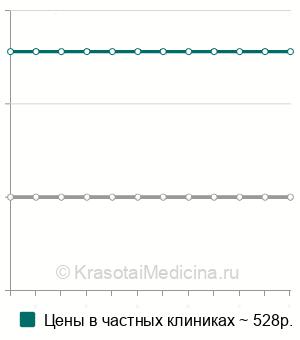 Средняя стоимость анализа на суммарный иммуноглобулин в Казани