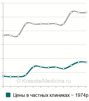 Средняя стоимость анализ крови на прокальцитонин в Казани
