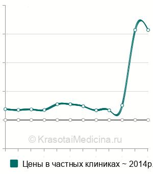 Средняя стоимость анализ на антитела к циклическому цитруллиновому пептиду (anti-ССР) в Казани