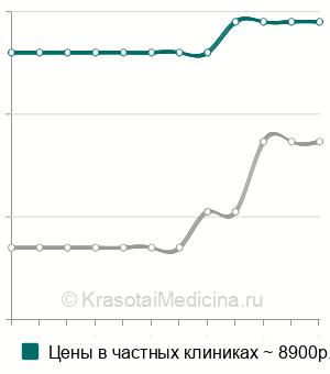 Средняя стоимость спинально-эпидуральная анестезия в Казани