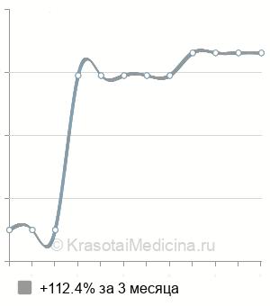 Средняя стоимость липофилинга молочных желез в Казани