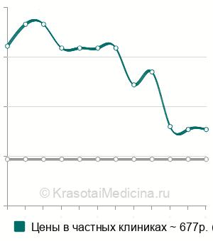 Средняя стоимость удаление инородного тела конъюнктивы в Казани