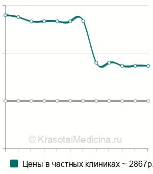 Средняя стоимость многокомпонентная мезотерапия волос в Казани