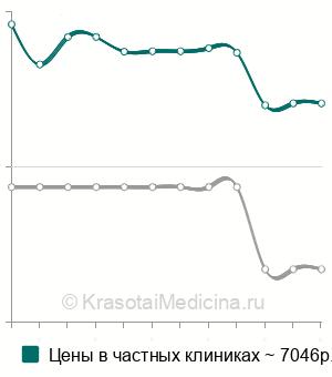 Средняя стоимость вкладка из диоксида циркония в Казани