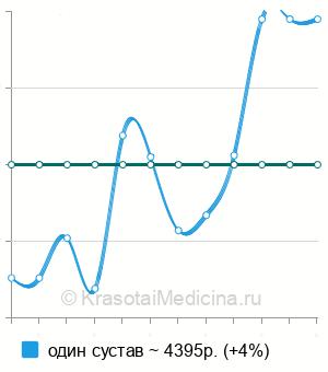 Средняя стоимость МРТ коленного сустава в Казани
