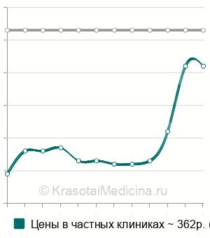 Средняя стоимость ПЦР диагностика уреаплазмоза (ureaplasma urealyticum) в Казани