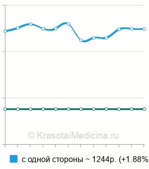 Средняя стоимость промывание гайморовых пазух через соустье в Казани